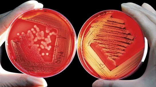 Inżynieria genetyczna w walce z chlamydiozą foto: pixabay